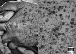 Sinteplast: We Age - Hands